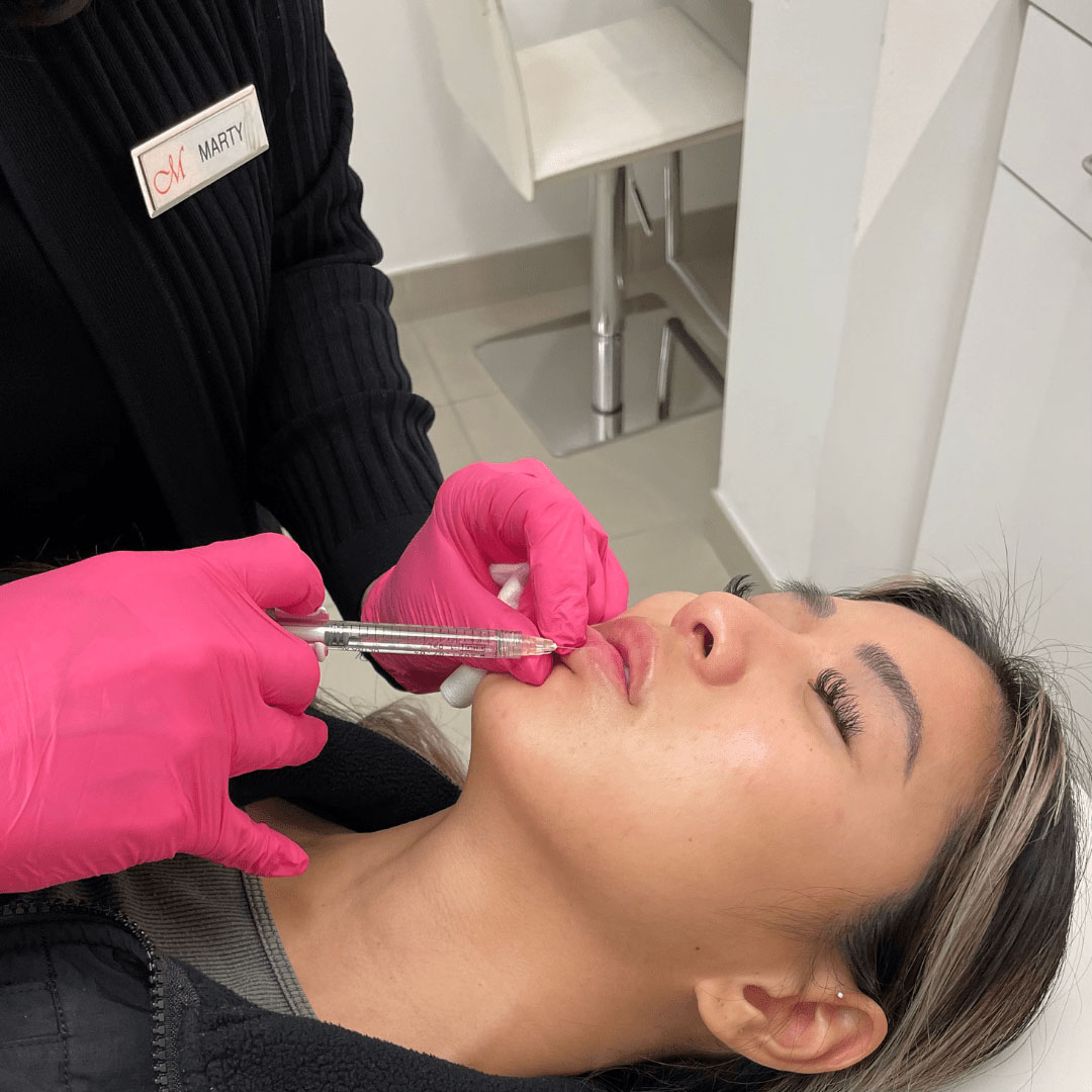 Mirror Mirror Beauty Boutique offers Lip Augmentation without the commitment, cost, and recovery of a surgical procedure.